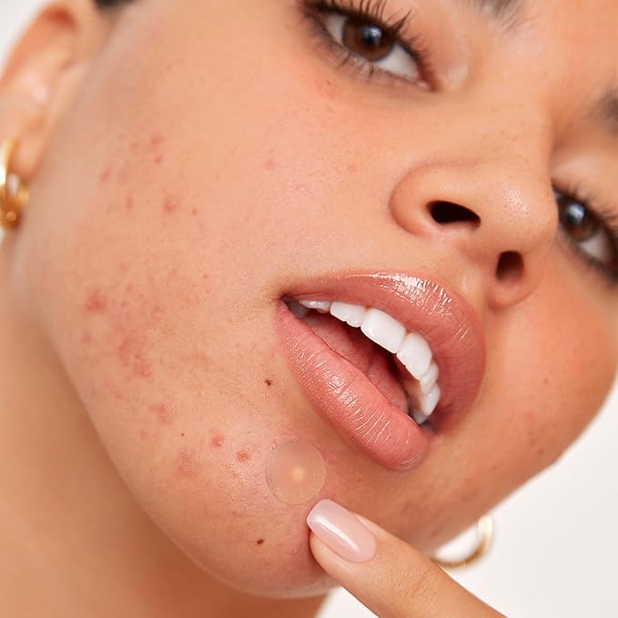 Peace Out Salicylic Acid Acne Healing Dots - 40ct