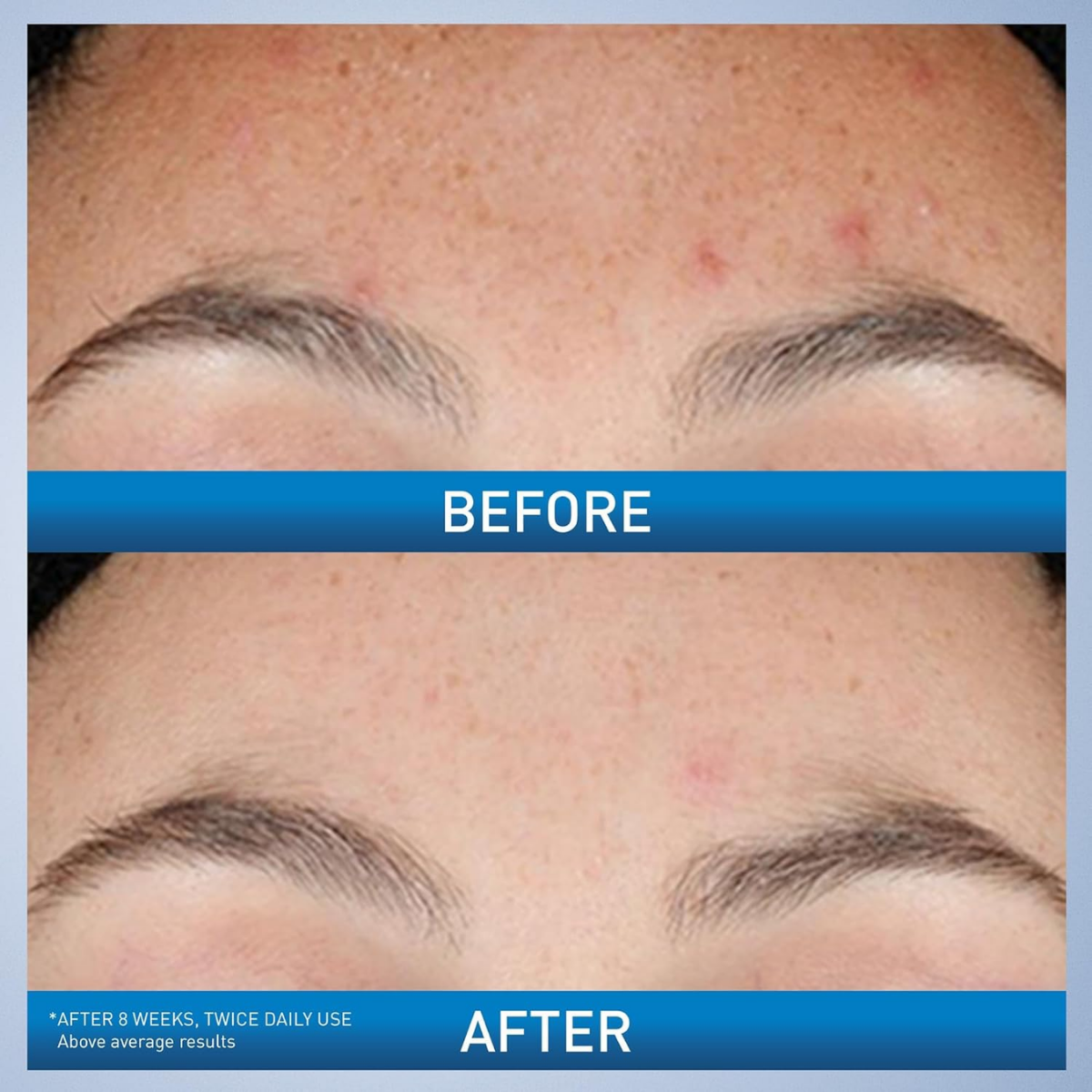 CeraVe Resurfacing Retinol Serum 1 FL OZ