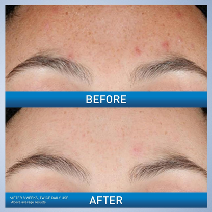 CeraVe Resurfacing Retinol Serum 1 FL OZ