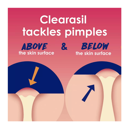 Clearasil Rapid Rescue Deep Treatment Pads - 90 Pads