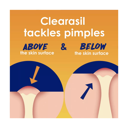 Clearasil Stubborn Acne Control 5in1 Daily Pads - 90ct