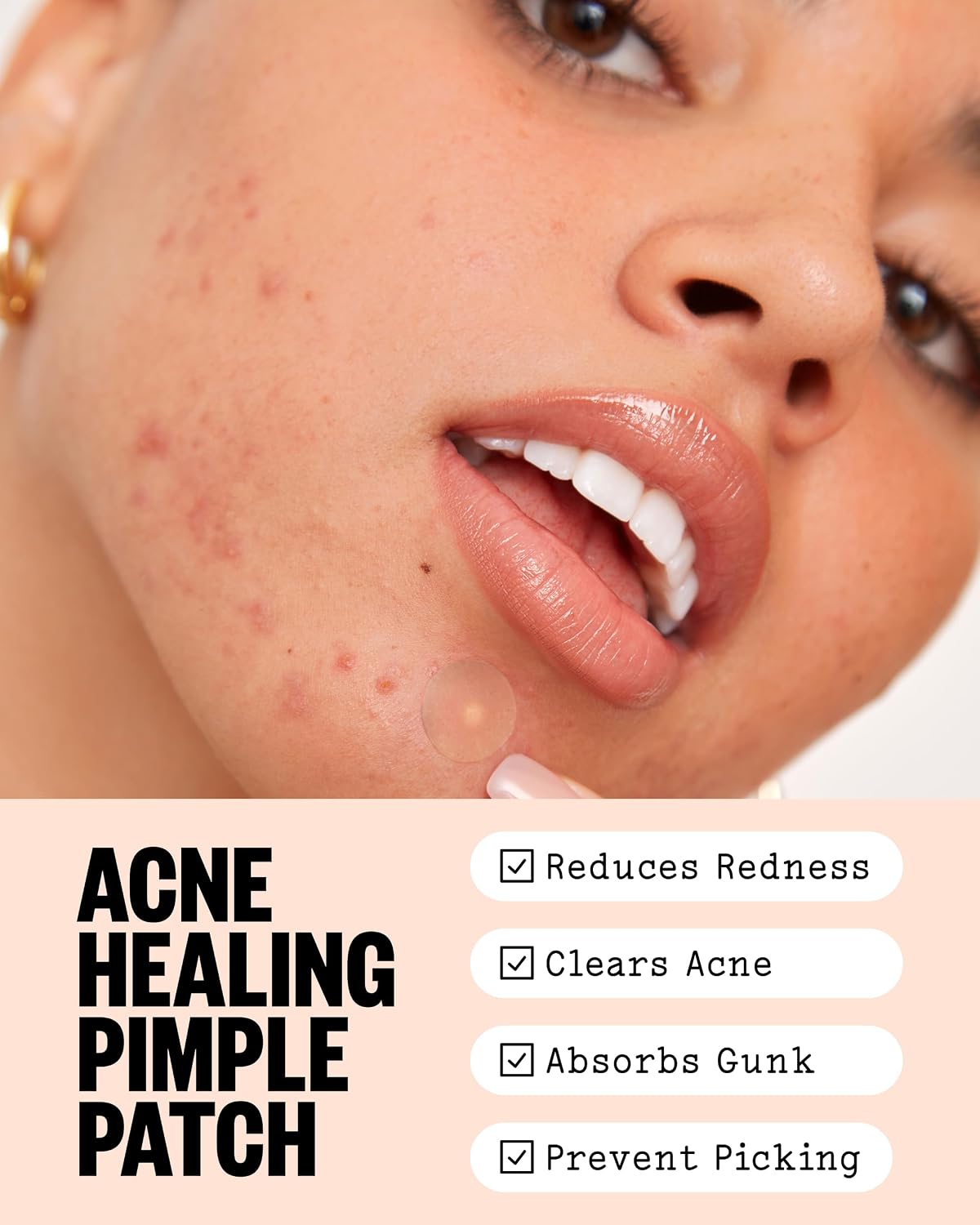 Peace Out Salicylic Acid Acne Healing Dots - 20ct