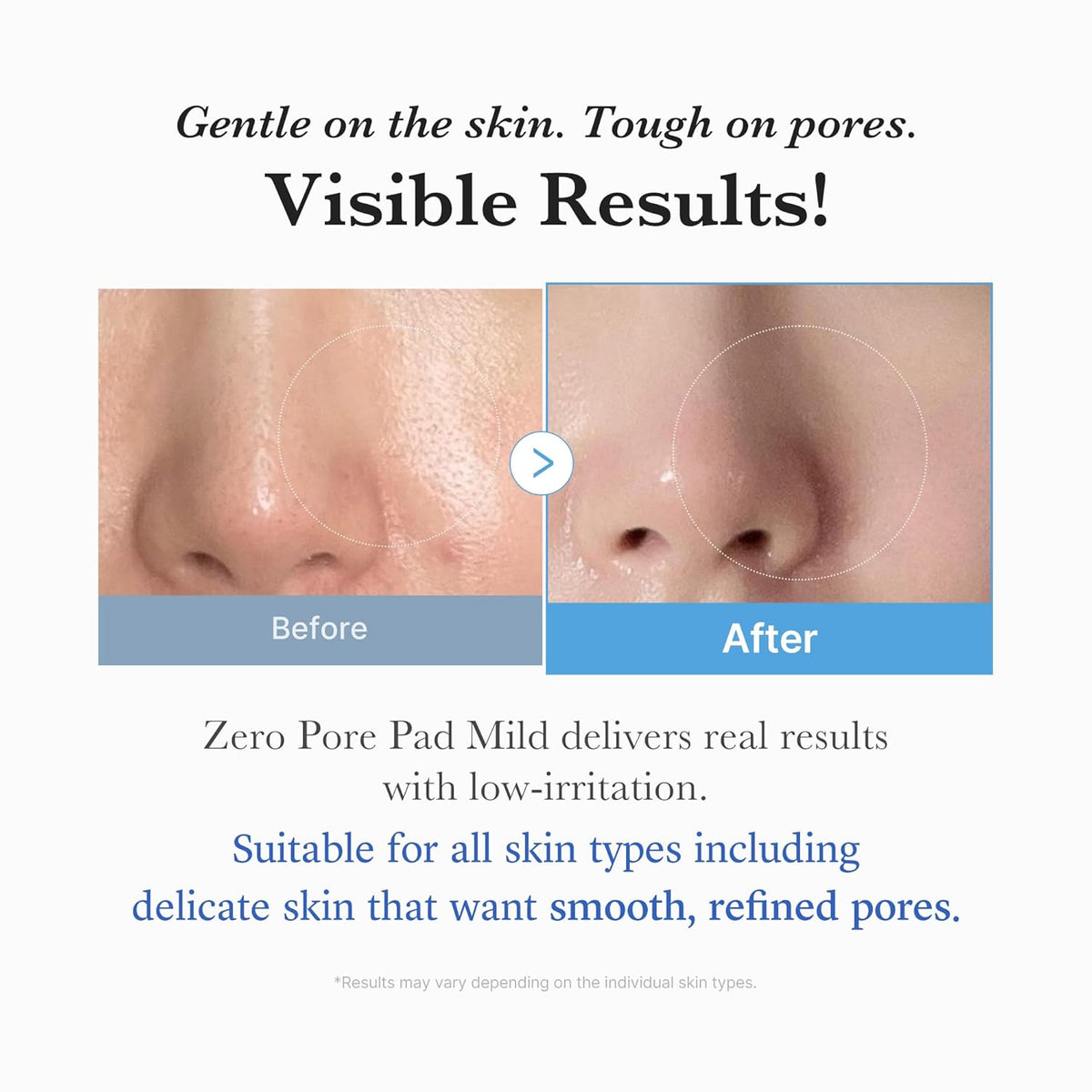 Medicube Toner Pads Zero Pore Pad Mild 2.0 - 5.46oz (70 pads)